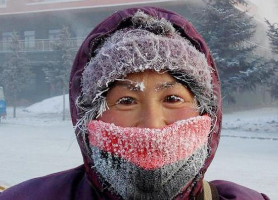 Hulunbuir's face frosted for a moment on an extremely cold day.